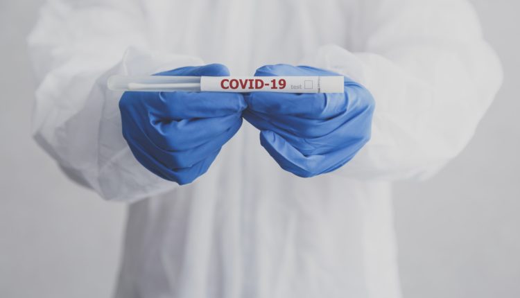 Laboratory technician hold coronavirus test tube for COVID-19 test